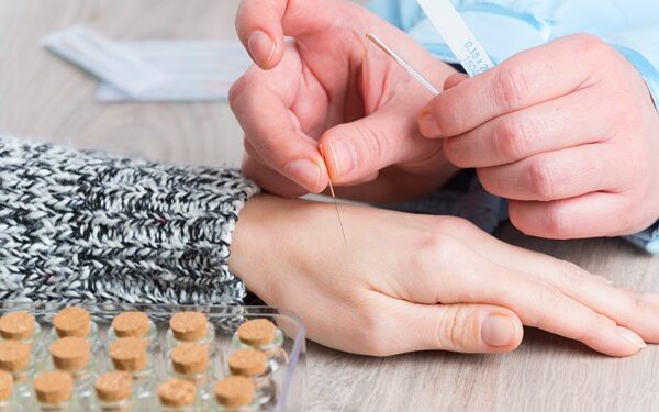 Ο βελονισμός μπορεί να χρησιμοποιηθεί ως μέσο καταπολέμησης του οδοντιατρικού άγχους