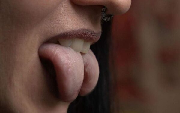 Διαχωρισμός γλώσσας (tongue splitting): Η νέα μόδα που ανησυχεί τους ειδικούς της στοματικής υγείας