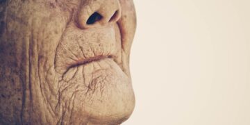 Έρευνα αναδεικνύει τους συσχετισμούς ανάμεσα στην απώλεια δοντιών και τον κίνδυνο υποσιτισμού