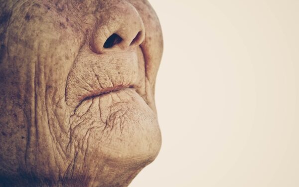 Έρευνα αναδεικνύει τους συσχετισμούς ανάμεσα στην απώλεια δοντιών και τον κίνδυνο υποσιτισμού