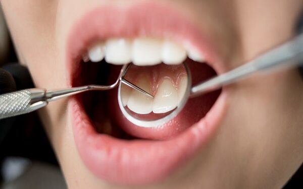 Άμεση και αποτελεσματική αντιμετώπιση του τραυματισμένου δοντιού