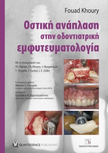 Οστική ανάπλαση στην οδοντιατρική εµφυτευµατολογία