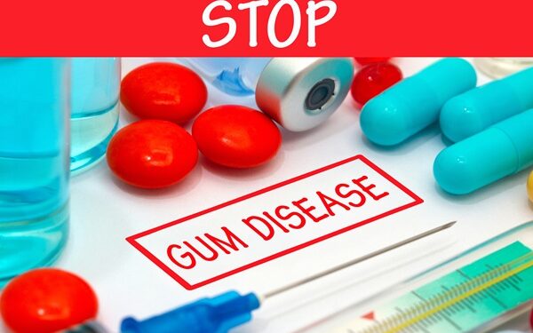 ΕFP:Απαιτείται παγκόσμια δράση για τη βελτίωση της υγείας των ούλων