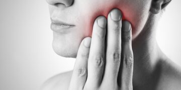 Περιοδοντίτιδα: Επηρεάζει την εκδήλωση ισχαιμικού εγκεφαλικού;