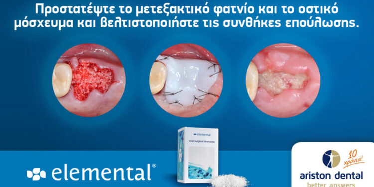 Εlemental – Προστατέψτε το μετεξακτικό φατνίο και το οστικό μόσχευμα και βελτιστοποιήστε τις συνθήκες επούλωσης.