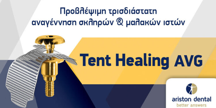 TENT HEALING AVG: To Nέο abutment για την τρισδιάστατη αναγέννηση σκληρών και μαλακών ιστών, από την Ariston Dental