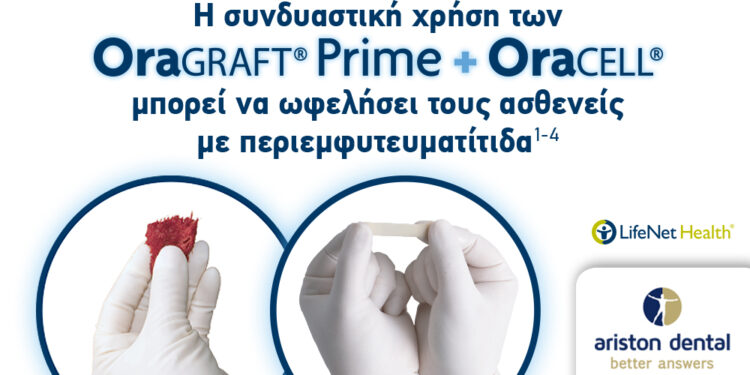 Συνδυασμός OraGraft Prime & OraCELL για μέγιστη αποτελεσματικότητα κατά της περιεμφυτευματίτιδας!