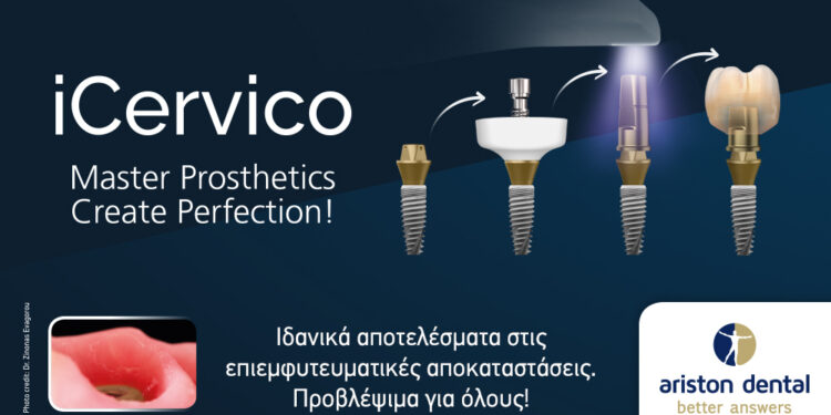iCervico by VPI. Ιδανικά αποτελέσματα στις επιεμφυτευματικές αποκαταστάσεις. Προβλέψιμα για όλους!