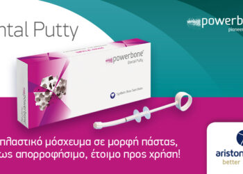 Powerbone Dental Putty – Αλλοπλαστικό μόσχευμα σε μορφή πάστας, έτοιμο προς χρήση!