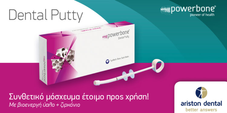 Powerbone® Dental Putty: Το συνθετικό μόσχευμα που κάνει την αναγέννηση, υπόθεση ρουτίνας