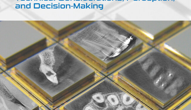 Advanced CBCT for Endodontics