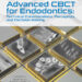 Advanced CBCT for Endodontics