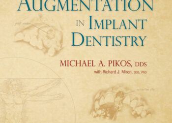 Bone Augmentation in Implant Dentistry