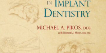 Bone Augmentation in Implant Dentistry