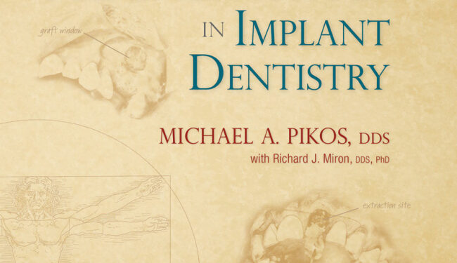 Bone Augmentation in Implant Dentistry