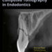 Cone Beam Computed Tomography in Endodontics