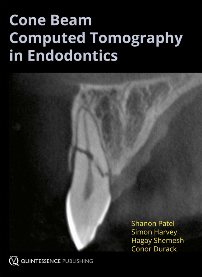 Cone Beam Computed Tomography in Endodontics