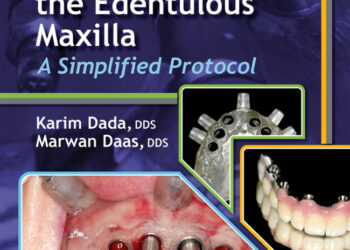 Esthetic Implant Restoration in the Edentulous Maxilla