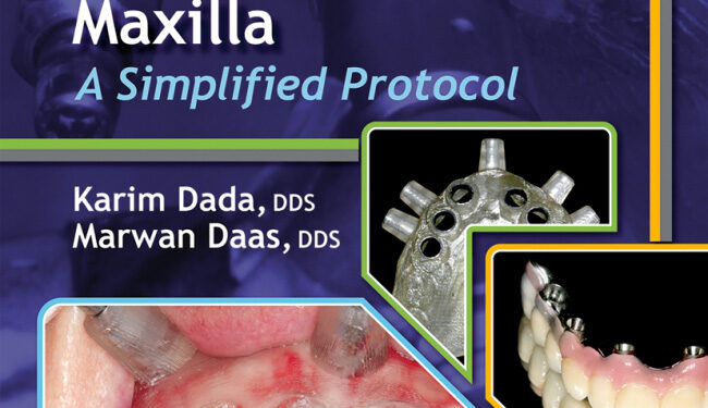 Esthetic Implant Restoration in the Edentulous Maxilla