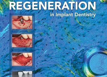 20 Years of Guided Bone Regeneration in Implant Dentistry