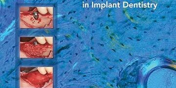20 Years of Guided Bone Regeneration in Implant Dentistry