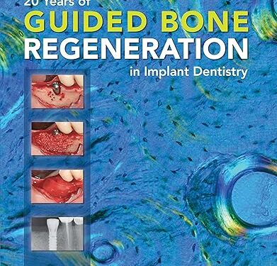 20 Years of Guided Bone Regeneration in Implant Dentistry