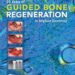 20 Years of Guided Bone Regeneration in Implant Dentistry