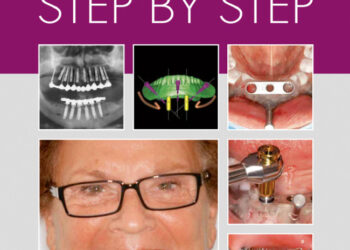 Implantology Step by Step