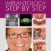 Implantology Step by Step