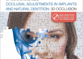 Occlusal Adjustments in Implants and Natural Dentition: 3D Occlusion
