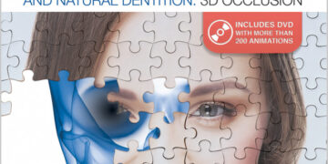 Occlusal Adjustments in Implants and Natural Dentition: 3D Occlusion