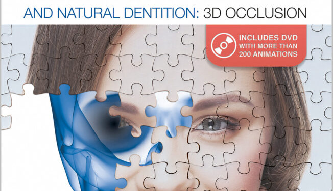 Occlusal Adjustments in Implants and Natural Dentition: 3D Occlusion