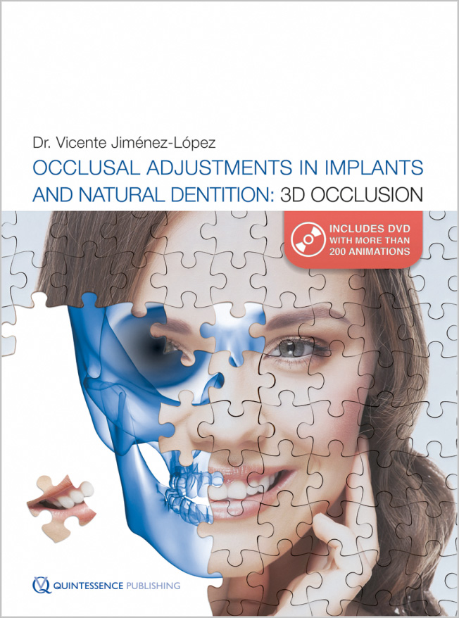 Occlusal Adjustments in Implants and Natural Dentition: 3D Occlusion