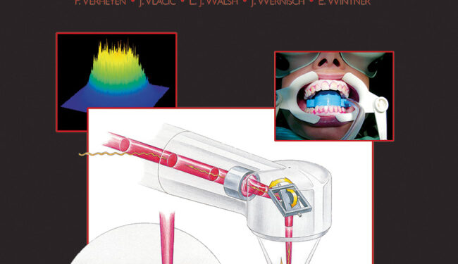 Oral Laser Application