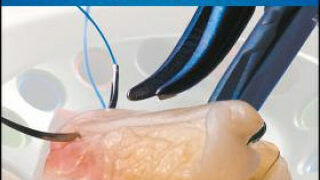 Platelet Rich Fibrin in Regenerative Dentistry