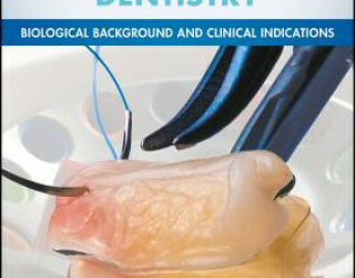 Platelet Rich Fibrin in Regenerative Dentistry