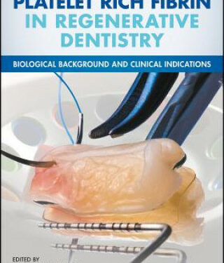 Platelet Rich Fibrin in Regenerative Dentistry