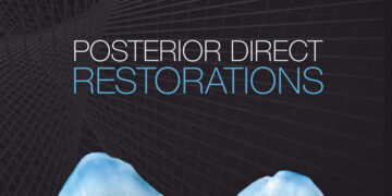 Posterior Direct Restorations