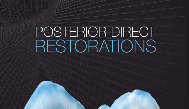 Posterior Direct Restorations