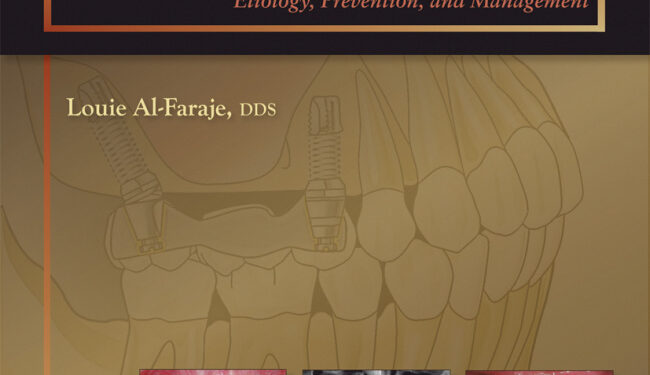 Surgical Complications in Oral Implantology