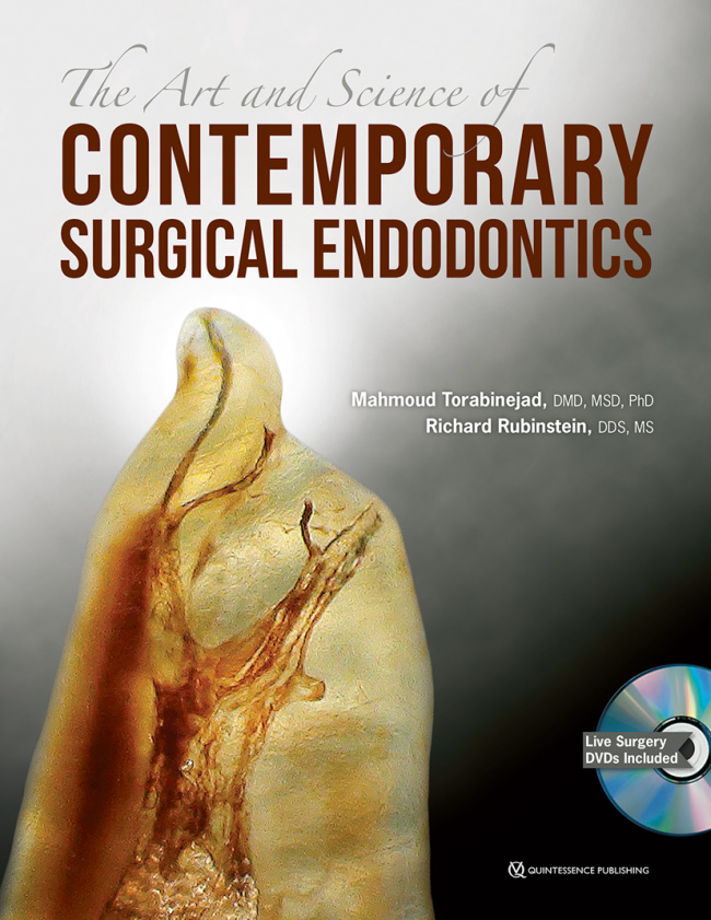 The Art and Science of Contemporary Surgical Endodontics